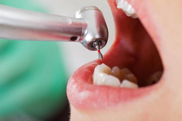 Best Urgent Dental Care for Toothache in Pembroke, VA